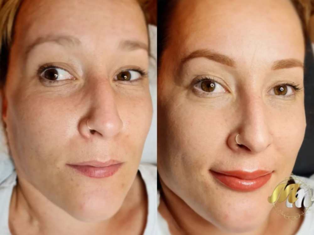 Antes y después micropigmentación labios 
